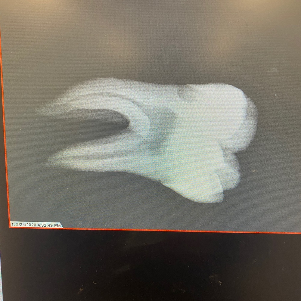 Meet your Posher, Joshua